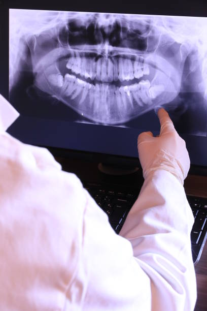 Best Walk-In Emergency Dentist in Glendive, MT