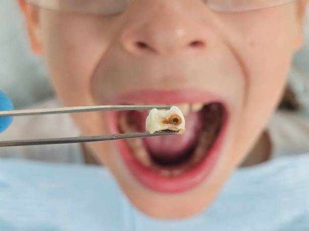 Best Emergency Dental Care for Trauma or Injury in Glendive, MT