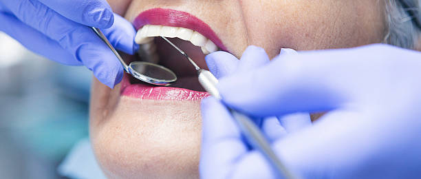 Best Emergency Tooth Extraction in Glendive, MT